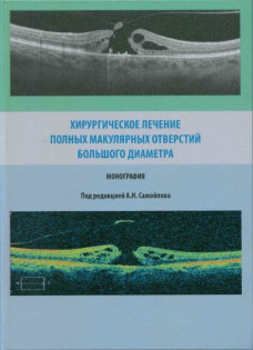 Хирургическое лечение заболеваний роговицы 1